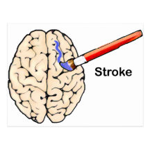 A Stroke Postcard
