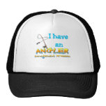 Angler Management Problem T-shirts and Gifts. Hat
