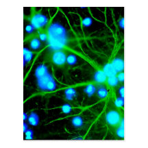 Astrocyte Are Star Shaped Glial Cells in the Brain Post Cards