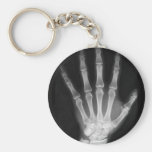 B&W X-ray Skeleton Hand Keychains