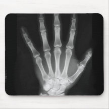 B&W X-ray Skeleton Hand Mousemats