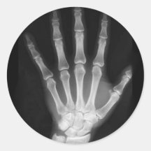 B&W X-ray Skeleton Hand Round Stickers