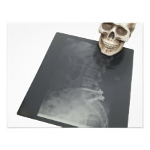 BonesXray061209 Custom Invite