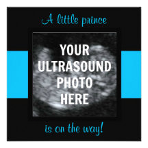 Boy Baby Customised Ultrasound Photo Template Invites