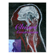 Chiari Awareness Postcard
