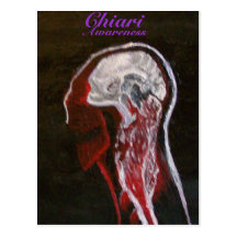 Chiari Awareness Postcard