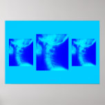 Chiropractic Poster: Lateral Cervical Blues