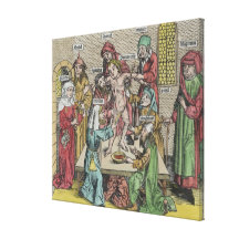 Circumcision Gallery Wrapped Canvas
