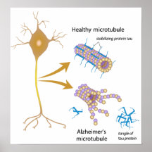 Disintegrating microtubules in Alzheimer's Poster