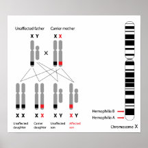 Genetics of haemophilia Poster