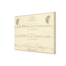 Idiots, Statistical US Lithograph 1870 Stretched Canvas Prints