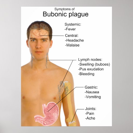 Main Symptoms of Black Death Bubonic Plague Chart Poster Zazzle