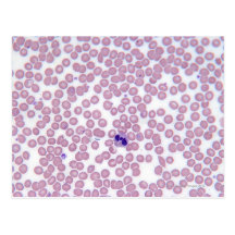 Malarial Blood Cells Post Cards