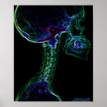 Multi-colour  C-Spine X-ray poster