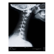 X ray of neck vertebrae including lower jaw post card