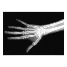 X-Ray Skeleton Arms Black & White Invitations