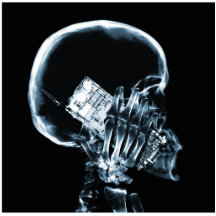 X-RAY SKELETON ON PHONE - BLUE PHOTO SCULPTURES