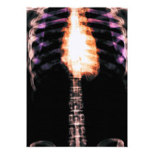 X-RAY SKELETON TORSO RIBS - ORIGINAL PERSONALIZED INVITATIONS