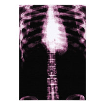 X-RAY SKELETON TORSO RIBS - PINK PERSONALIZED ANNOUNCEMENT