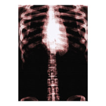 X-RAY SKELETON TORSO RIBS - RED PERSONALISED INVITATIONS