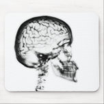 X-RAY SKULL BRAIN - BLACK & WHITE mousepads