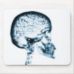 X-RAY SKULL BRAIN - BLUE mousepads