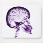 X-RAY SKULL BRAIN - PURPLE mousepads