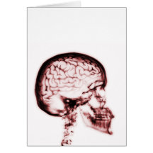 X-RAY SKULL BRAIN - RED CARD