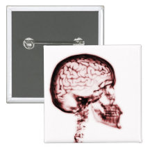 X-RAY SKULL BRAIN - RED PINS