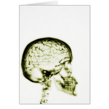 X-RAY SKULL BRAIN - YELLOW GREETING CARD