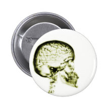 X-RAY SKULL BRAIN - YELLOW PINS