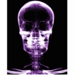 X-RAY VISION SKELETON SKULL - PURPLE PHOTO SCULPTURE