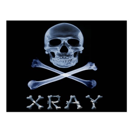 XRAY PIRATE Flag RADIOLOGY JOLLY ROGER Postcards