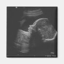 Search for ultrasound magnets Baby