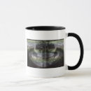 Search for fracture mugs Bone