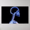 Search for x ray bones posters People