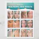 Search for surface flyers Professional