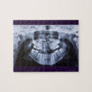 Search for dental puzzles Close up