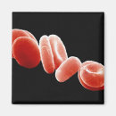Search for colour effect magnets Electron micrography