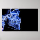 Search for jaw bone posters Human teeth