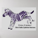 Search for ehlers danlos syndrome Strong