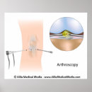 Search for knee posters Orthopaedic