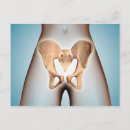 Search for human bones postcards Hip