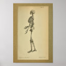 Search for vintage medical skeleton posters Bones