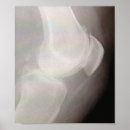Search for knee posters Joint