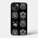Search for brain iphone cases Anatomy