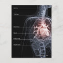 Search for respiratory system postcards Vertical