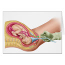 Search for childbirth postcards Amniotic sac
