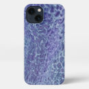 Search for snow white iphone cases Blue