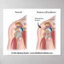 Search for chiropractor posters Anatomy